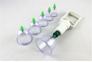 cupping therapy kit