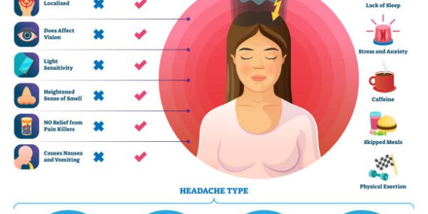 migraine Migraine vector illustration. Labeled abdominal headache triggers and types scheme. Visualized sinus, cluster and tension pulsation head feelings. Educational strong severe throbbing pain comparison.